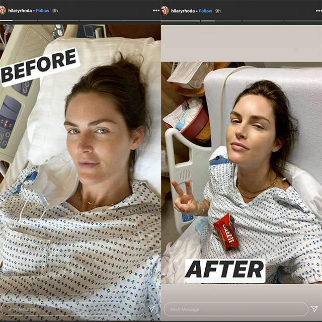 hilary-rhoda-before-after-baby