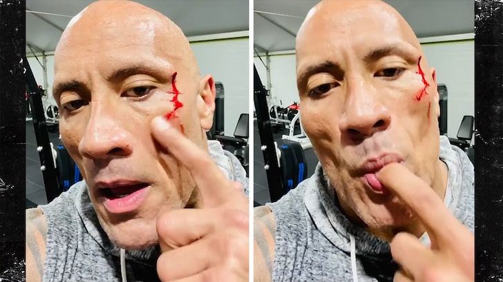 The Rock Tastes His Own Blood After Gym Injury, Gets Stitches to Close Gash