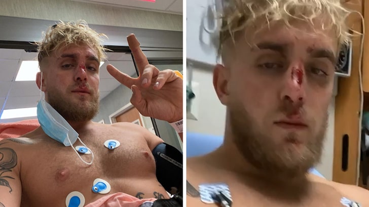 Jake Paul Shows Bloody Footage of Broken Nose He Suffered 3 Weeks Before Fight