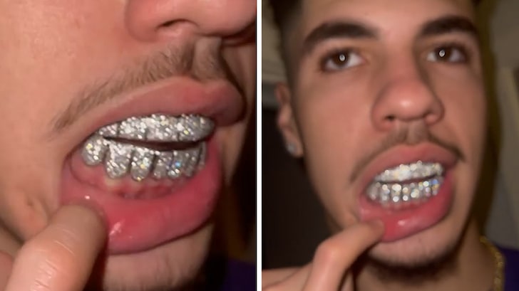 LaMelo Ball Cops Baller Diamond Grill With 14k Gold, Welcome To The NBA!