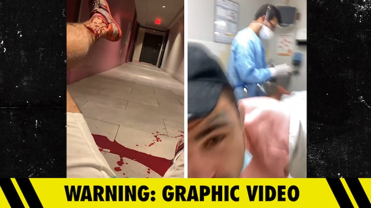 UFC's 'Platinum' Mike Perry Gets Foot Stitched Up After Concerning Bloody Incident