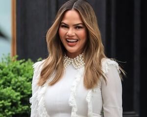 Chrissy Teigen Loses Tooth in Fruit Roll-Up Accident